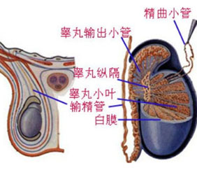 睾丸炎的分类及检查