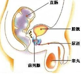 慢性前列腺炎的病因病机