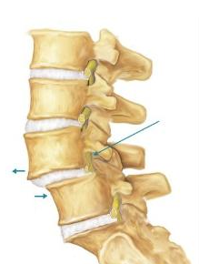 腰椎滑脱怎么治疗最好