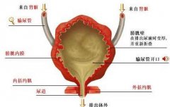 膀胱炎有哪些症状？