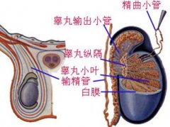 什么是睾丸炎