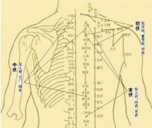 成都现代医院中医骨科“三伏灸”预约报名中